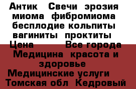 Антик.  Свечи (эрозия, миома, фибромиома, бесплодие,кольпиты, вагиниты, проктиты › Цена ­ 550 - Все города Медицина, красота и здоровье » Медицинские услуги   . Томская обл.,Кедровый г.